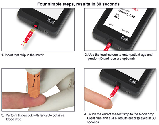 Nova Max Pro - Detection of Kidney Disease Outside the Hospital - A New Easy  to Use Tool to Detect Early - Stage Kidney Disease